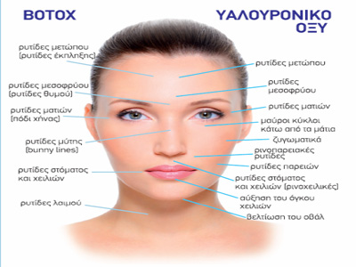 Botox ή υαλουρονικό οξύ; Τι να επιλέξετε και γιατί