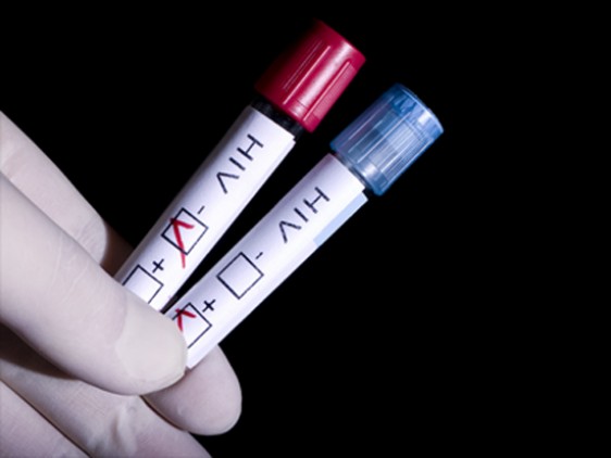 Διαγνωστικό τεστ για τον ιό  HIV θα πωλείται από φαρμακεία στη Βραζιλία