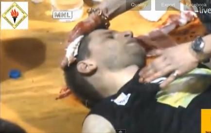 Τραυματισμός-σοκ στο κλειστό του Σπόρτιγκ