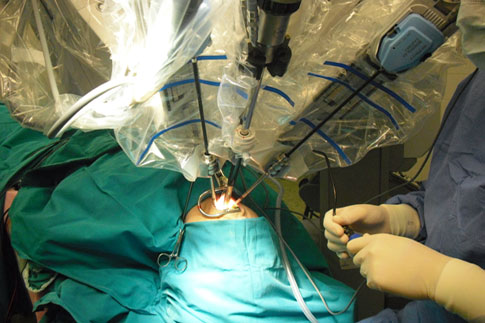 ΩΡΛ: Η ρομποτική χειρουργική μειώνει τις επιπλοκές και βελτιώνει το θεραπευτικό αποτέλεσμα