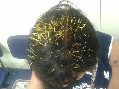 Ακριβά πλήρωσε μια βραζιλιάνα την πτώση σκαντζόχοιρου στο κεφάλι της