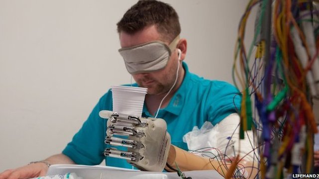 Τεχνητό χέρι ξαναδίνει στον ασθενή την αίσθηση της αφής