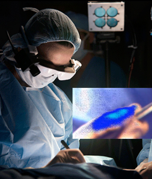 Έξυπνα  γυαλιά επιτρέπουν στο χειρουργό να βλέπει τον καρκίνο