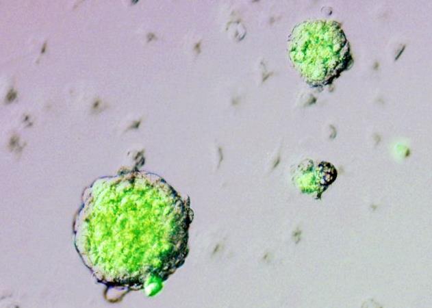 Υπό αμφισβήτηση η μελέτη-ορόσημο για τα βλαστικά κύτταρα