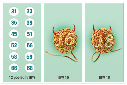 Υπό έγκριση νέο διαγνωστικό τεστ για τον καρκίνο του τραχήλου της μήτρας