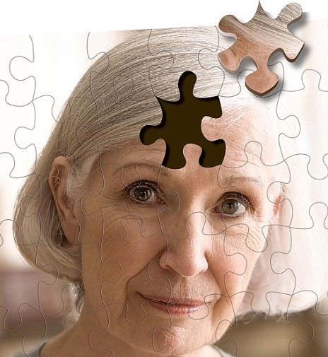 Γονίδιο καθιστά τις γυναίκες πιο ευάλωτες στη νόσο Αλτσχάιμερ
