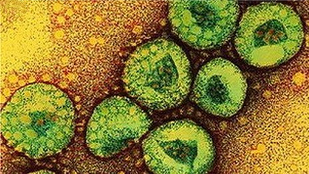 Όλα όσα πρέπει να γνωρίζετε για τον ιό MERS