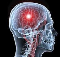 Επιστημονική ημερίδα για τα «Αγγειακά Εγκεφαλικά Επεισόδια»