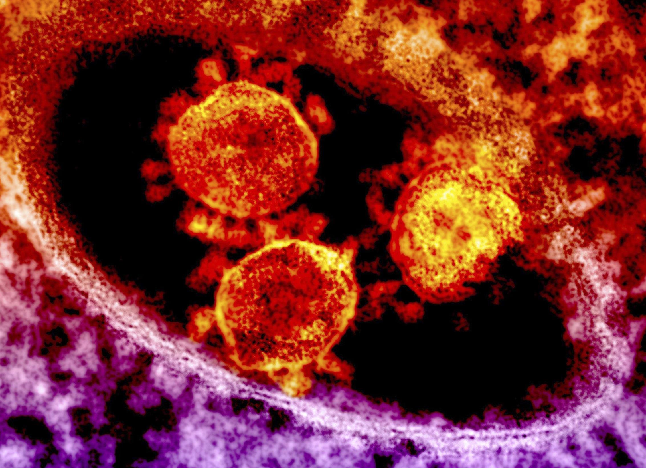 Άλλοι δύο νεκροί από τον ιό MERS στη Σαουδική Αραβία