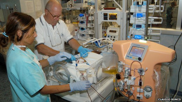 Σύστημα τεχνητού νεφρού αποκλειστικά για βρέφη δημιούργησαν ιταλοί ερευνητές