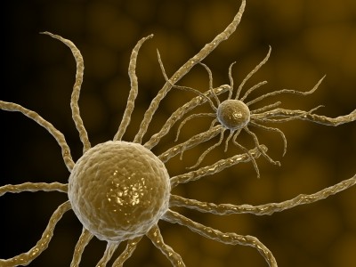 Εξέταση πρώτης γραμμής το τεστ cobas HPV στη διάγνωση του καρκίνου του τραχήλου της μήτρας