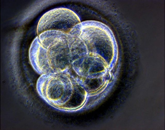 H EE αρνείται να μπλοκάρει τις έρευνες σε εμβρυακά βλαστοκύτταρα