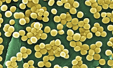 Ελπίδες καλύτερης αντιμετώπισης των υπερανθεκτικών μικροβίων
