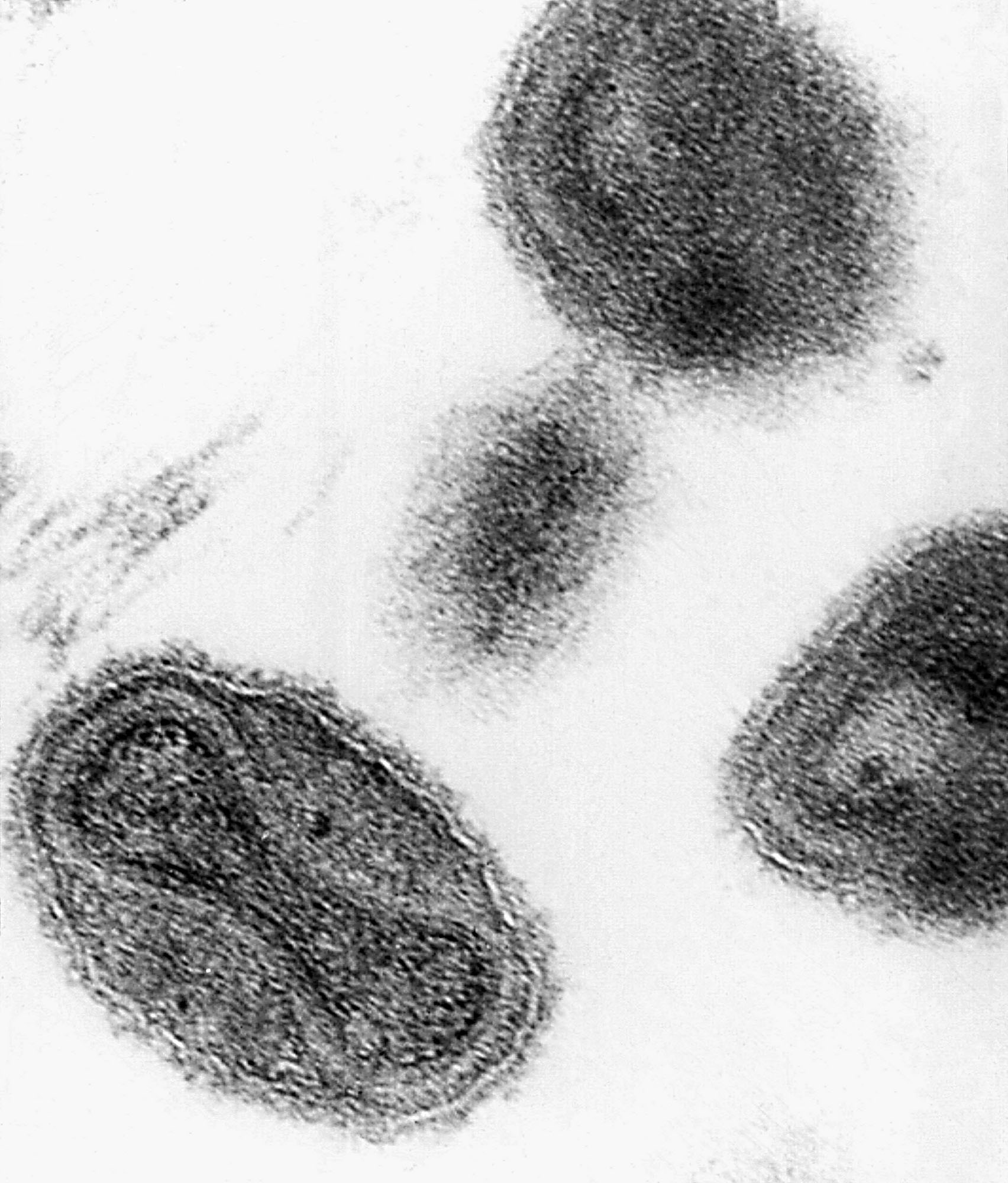 Ξεχασμένα φιαλίδια με τον ιό της ευλογιάς βρέθηκαν σε αμερικανικό εργαστήριο
