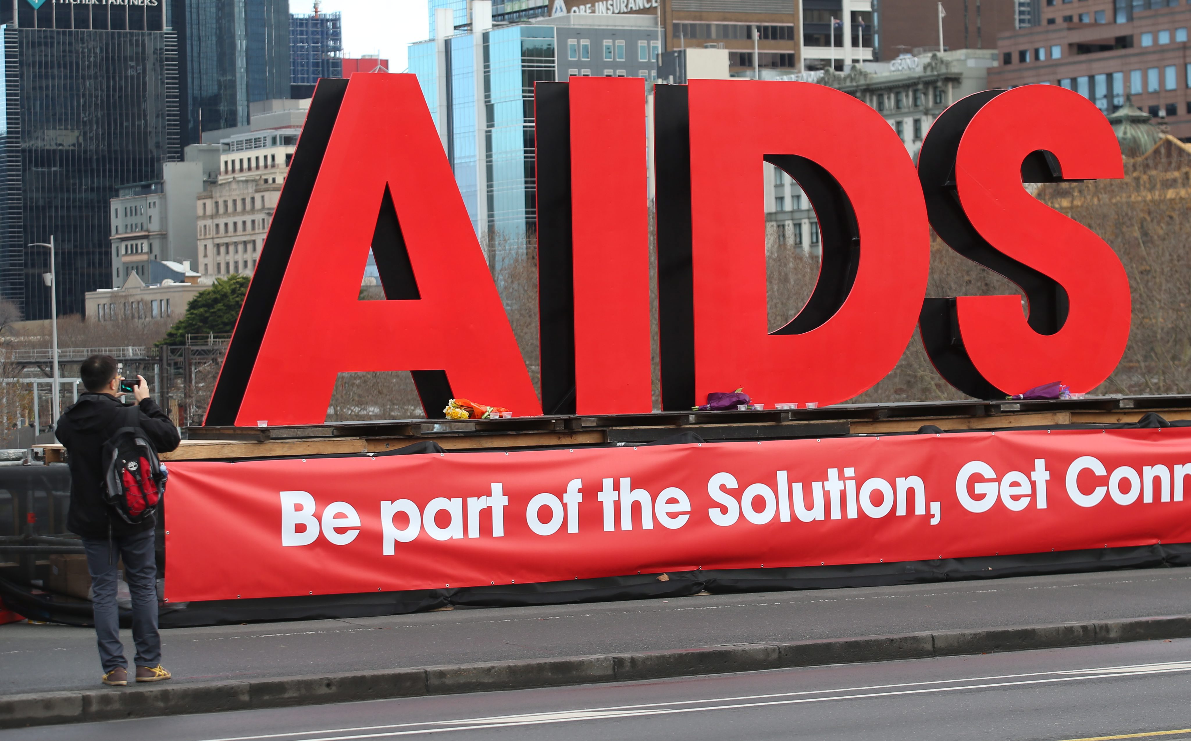 Η περιτομή «όπλο» στη μάχη κατά του AIDS στην υποσαχάρια Αφρική