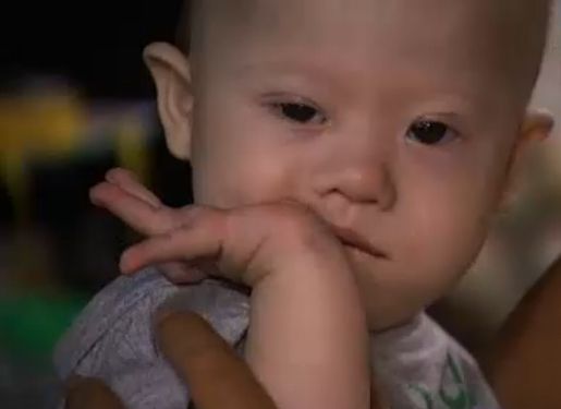 Ταϊλάνδη: Παρένθετη μητέρα ανέλαβε να μεγαλώσει μωρό με σύνδρομο Down