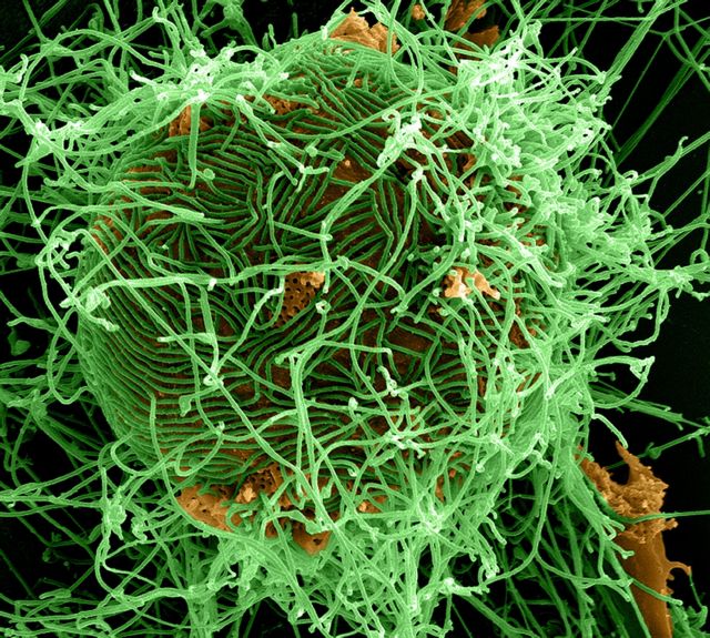 Αρνητικός στον ιό Έμπολα ο Σουηδός που είχε τεθεί σε καραντίνα