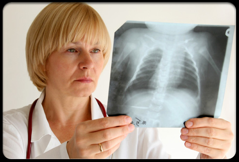 Ακτινολογία & Ακτινοθεραπεία: Είναι επικίνδυνη η ακτινοβολία για τον άνθρωπο;