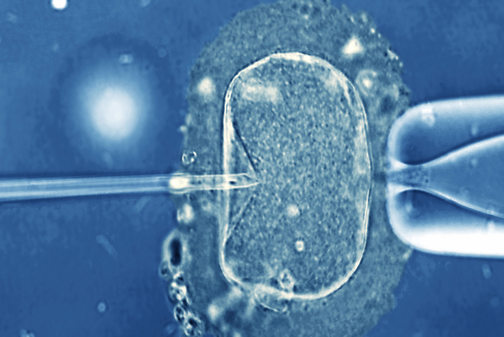 Νέες εξετάσεις εντοπίζουν γενετικές ανωμαλίες πριν την εμφύτευση του εμβρύου