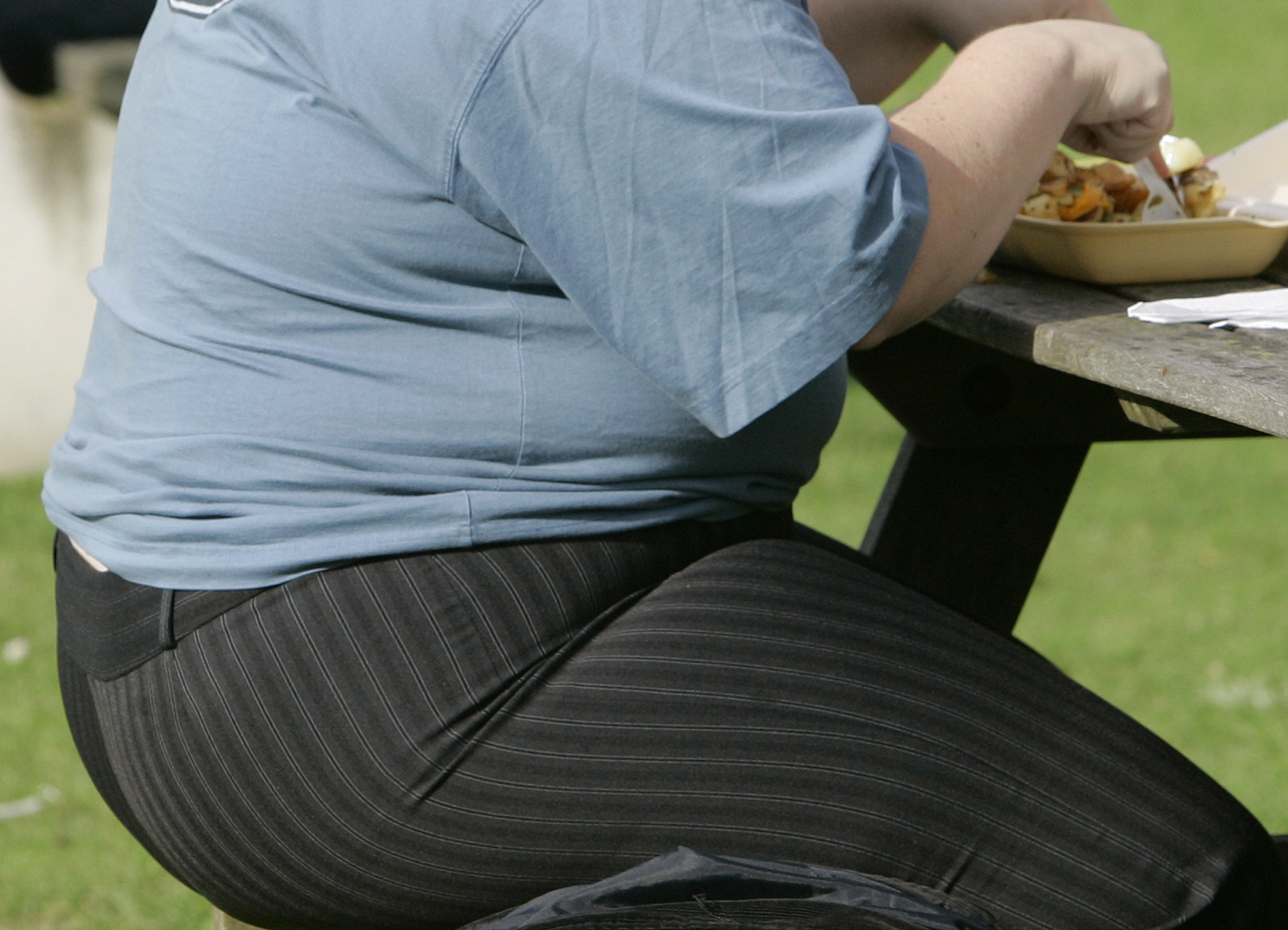 Η παχυσαρκία μειώνει το προσδόκιμο ζωής έως και οκτώ χρόνια
