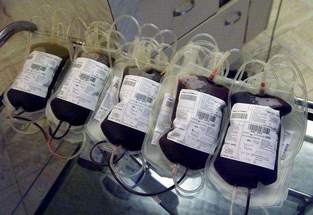Δότες αίματος και οι ομοφυλόφιλοι εισηγείται ο FDA στις ΗΠΑ