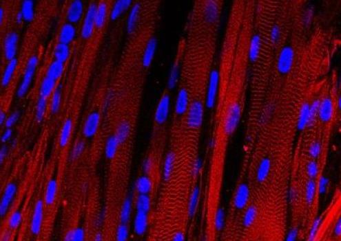 Καλλιεργημένοι ανθρώπινοι μύες αρχίζουν τις συσπάσεις