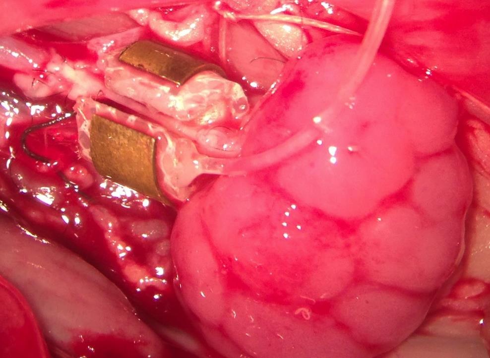 Ανθρώπινοι νεφροί αναπτύσσονται μέσα σε πειραματόζωα