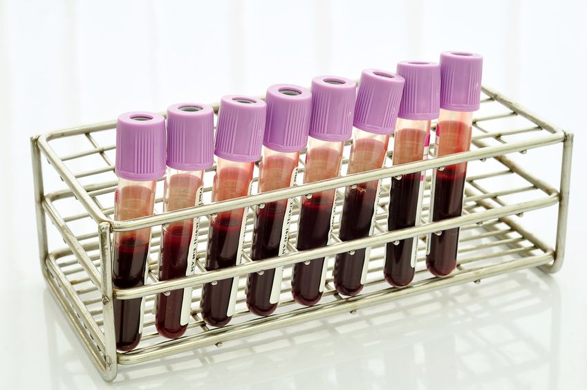 Πως η ομάδα αίματος επηρεάζει την υγεία και το προσδόκιμο ζωής;