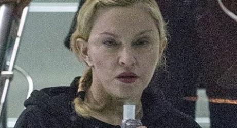 Τι συμβαίνει με την Madonna; Δείτε την τεράστια αλλαγή στο πρόσωπό της
