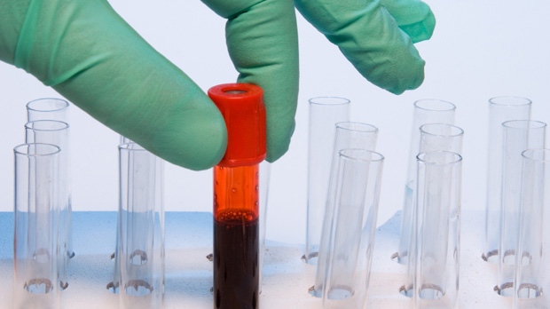 Ταχεία ανάλυση αίματος διακρίνει αν η λοίμωξη οφείλεται σε ιό ή βακτήριο