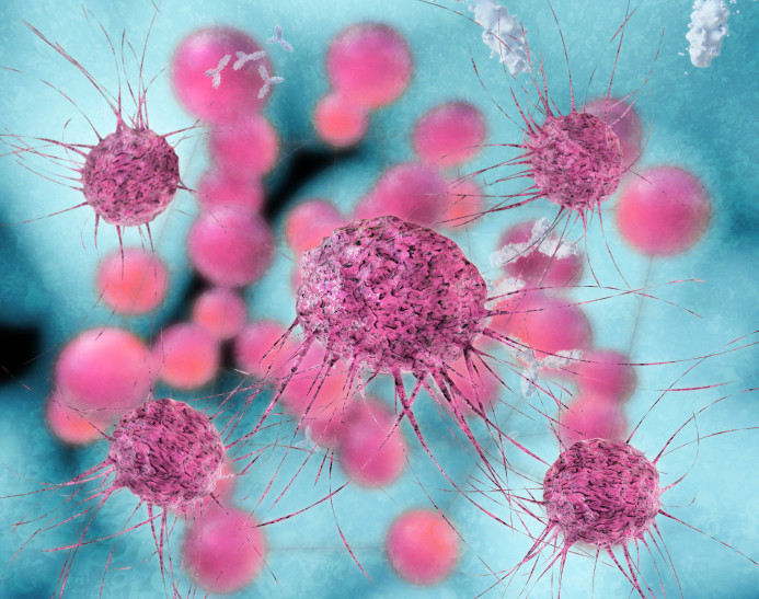 Εξέταση ανιχνεύει τη γενετική προδιάθεση για καρκίνο μαστού και ωοθηκών