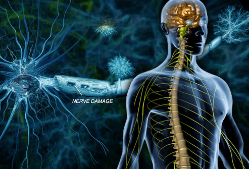 Πειραματική θεραπεία αποκαθιστά τις νευρικές βλάβες στην πολλαπλή σκλήρυνση