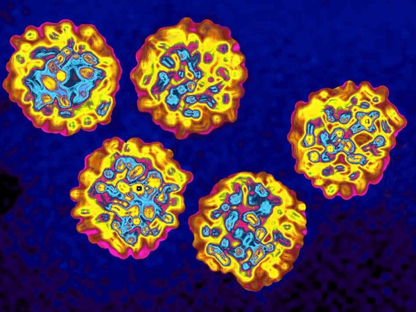 Συνδυαστική θεραπεία πετυχαίνει ίαση της ηπατίτιδας C σε ασθενείς με HIV