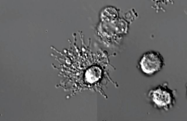 Ο θάνατος ενός λευκού αιμοσφαιρίου μπροστά στην κάμερα