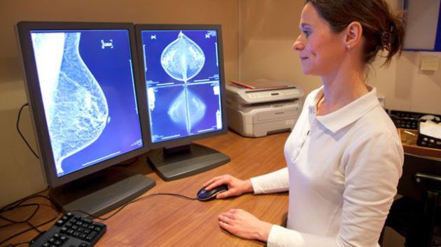 Tεστ καθορίζει την αναγκαιότητα της χημειοθεραπείας στον καρκίνο μαστού