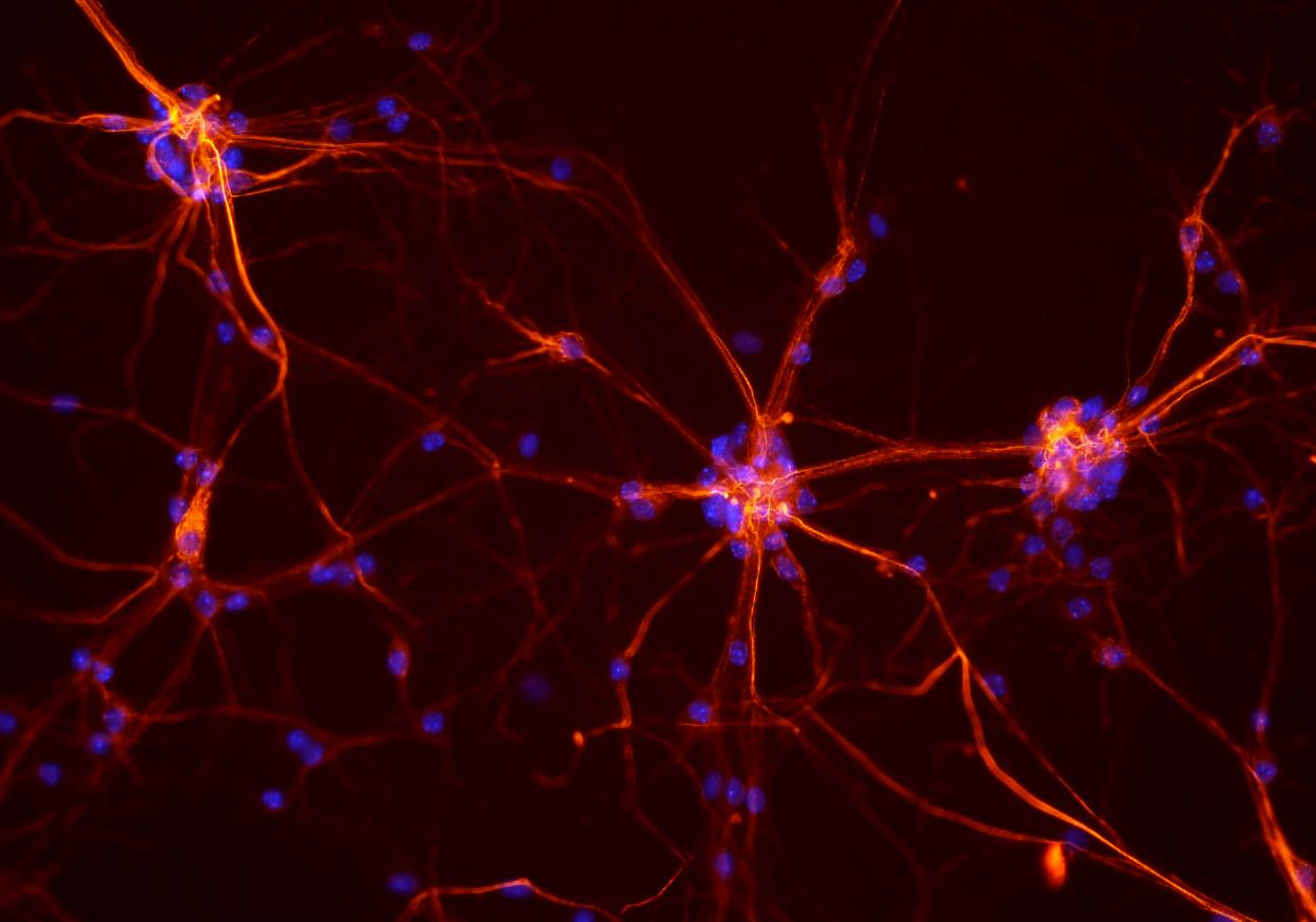 Εκατοντάδες μεταλλάξεις συσσωρεύονται σε κάθε νευρώνα του εγκεφάλου