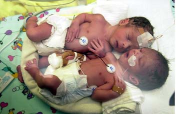 Το τελευταίο μωρό του 1999 και το πρώτο του 2000 είναι δίδυμα