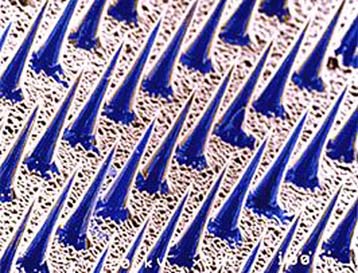 Νέα, μικροσκοπική και κυρίως ανώδυνη ένεση