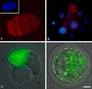 Πειράματα σε μύγες για την εξήγηση και θεραπεία προβλημάτων ακοής στον άνθρωπο