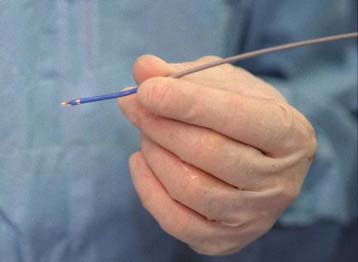 Εξυπνο νυστέρι με λέιζερ διακρίνει τα καρκινικά κύτταρα από τα υγιή