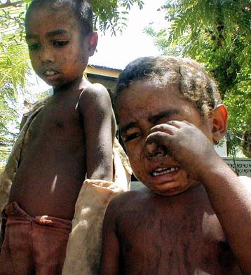 Στον ίδιο αριθμό έφτασαν οι παχύσαρκοι και οι υποσιτισμένοι στον κόσμο