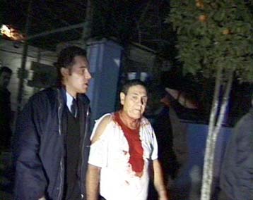 Ανεξέλεγκτη η κατάσταση στις φυλακές ανηλίκων Αυλώνα – Σοβαρά τραυματισμένος ένας κρατούμενος