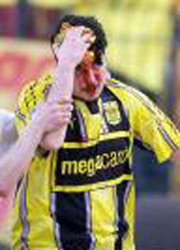 Ζημιές 60 εκατομμυρίων δραχμών στο γήπεδο της Τούμπας