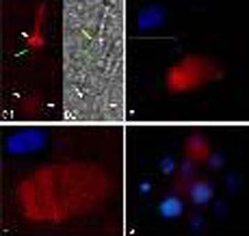 Η γήρανση συνδέεται με αύξηση των λαθών κατά τη διαίρεση των κυττάρων