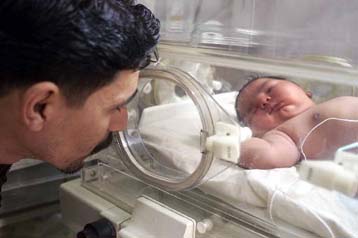 Μειώνονται οι γεννήσεις παιδιών με σύνδρομο Down και μεσογειακή αναιμία στην Ελλάδα