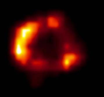 To Chandra φωτογράφησε ωστικό κύμα από υπερκαινοφανή αστέρα