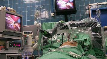 Η στείρωση είναι η πιο συνηθισμένη μορφή αντισύλληψης στις ΗΠΑ