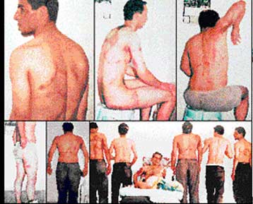 Σάλος στην Τουρκία από νέες φωτογραφίες κρατουμένων που φέρουν σημάδια βασανισμού