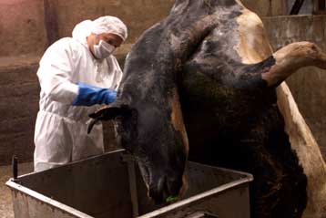 Φόβοι για σιωπηλά χτυπήματα της ασθένειας Κρόιτσφελντ-Γιάκομπ