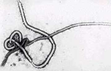 Ανακάλυψη πρωτεΐνης-κλειδί για την αντιμετώπιση του Εμπολα